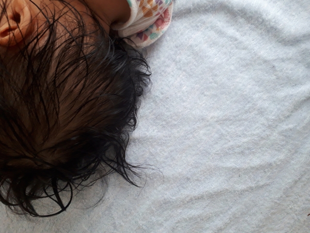 汗をかいている赤ちゃんの頭